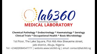 Rheumatoid Factor test from LAB360 Medical Laboratory [upl. by Fredel]