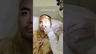 Avignon Clinic Under Eye Fillers using Belotero or Juvederm [upl. by Ahsenhoj]