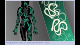 Lymphatic Filariasis Elephantiasis  Life Cycle [upl. by Nairrot894]