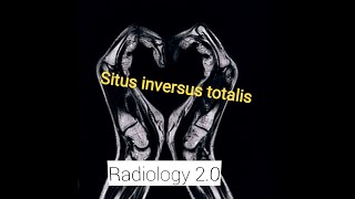 Case Report CT AbdomenSitus Inversus Totalis Situs SolitusSitus AmbiguusHeterotaxia syndrom [upl. by Laure]