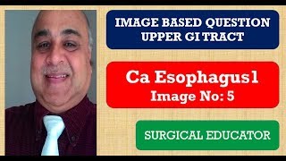 CARCINOMA ESOPHAGUS 1 UPPER GI TRACT Image Based Questions [upl. by Nollad165]