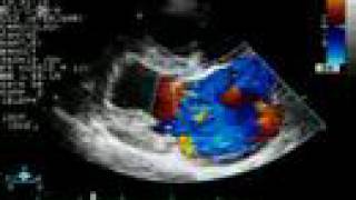 Mitral Regurgitation  Color Doppler Echocardiogram  Dog [upl. by Enaelem81]