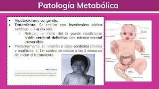 Patología Metabólica del Recién Nacido HIPOCALCEMIA e HIPOTIROIDISMO  Pediatría [upl. by Norval679]