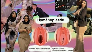 hyménoplastie musulmane elle ment sur leur virginité et se moque de lhonneur du marié islam [upl. by Yngiram]