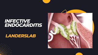 Infective Endocarditis [upl. by Esinrahc]