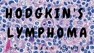 HODGKINS LYMPHOMA II ROBBINS 10TH E II HEMATOLOGY [upl. by Oiracam]