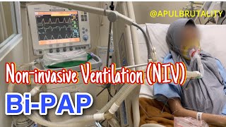 Noninvasive ventilation NIV with bilevel positive airway pressure biPAP [upl. by Rubma877]