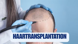 Haartransplantation in der Türkei [upl. by Annawak550]