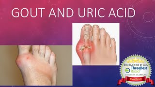 Gout and Hyperuricemia [upl. by Dercy]