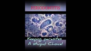 Periodontitis choice biology microscope Trichomonas tenax [upl. by Oiluig]