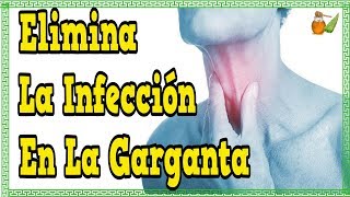 Que Tomar Para El Dolor De Garganta  Elimina La Infeccion En La Garganta [upl. by Mistrot791]