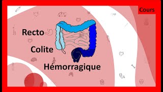 Questce que la rectocolite hémorragique 🤢💩  Cours  HépatoGastroEntérologie [upl. by Naillig]