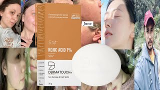 Dermatouch Kojic Acid Soap  Honest Review [upl. by Sheelagh]