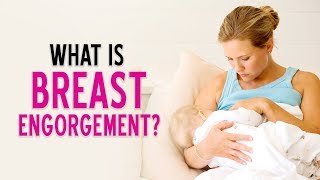 What is Breast Engorgement  DrPankaj Parekh  Dr Priti gangan  Lectsian Series  Child And You [upl. by Basilius]