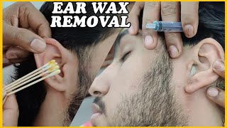 Nasty Ear Cleaning and Wax Removal with Hydrogen Peroxide by REIKI MASTER💈asmr [upl. by Poppo254]