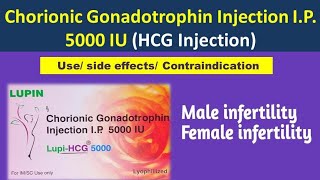 LupiHCG 5000 IU injection  Chorionic Gonadotrophin Injection IP 5000 IU Use [upl. by Arlinda504]