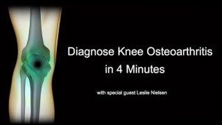 Diagnose Knee Osteoarthritis in 4 Minutes with Leslie Nielsen [upl. by Idham]