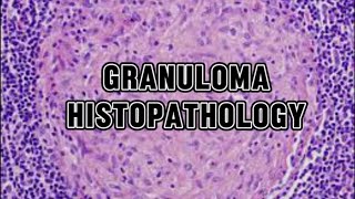 GRANULOMA  HISTOPATHOLOGY AND MORPHOLOGY [upl. by Afton17]