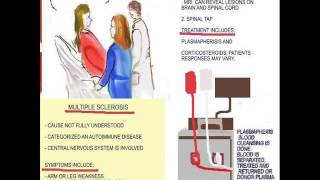 THE NEW NURSE  MULTIPLE SCLEROSIS AND PLASMAPHERESIS [upl. by Kavita807]