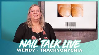 Trachyonychia  Derma Talk Nail Talk Live [upl. by Dryfoos]