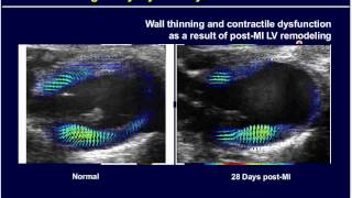 Webinar Cardiovascular Research with Prof Brent French  VisualSonics [upl. by Eillat738]