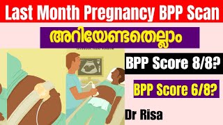 9 month Pregnancy ScanLast Month Pregnancy ScanWhat is BPP score [upl. by Daniala]