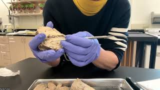 Sheep Brain Dissection [upl. by Gerstner126]