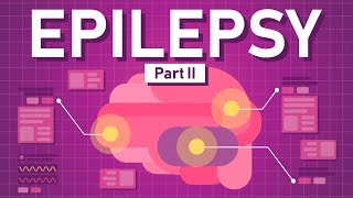 Causes of Epilepsy and How to Treat it [upl. by Allain840]