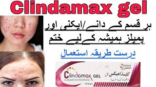 clindamax gel for acne reviews Climdamycin Treatment of acneHow to use clindamax gel side effects [upl. by Michi]