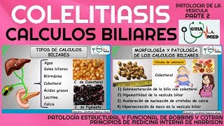 CÁLCULOS BILIARES FISIOPATOLOGÍA PARTE 2  GuiaMed [upl. by Ahsemed247]