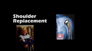 Total Shoulder Replacement  GeorgeMurrellShoulders [upl. by Navi834]