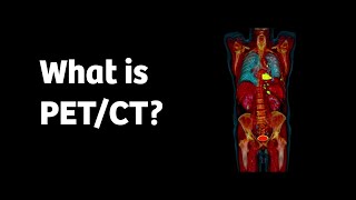 What is PETCT and how does it work [upl. by Drapehs]