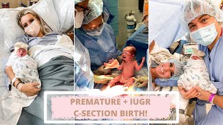 BLAKELYS BIRTH STORY  IUGR PREEMIE   RAW EMOTIONAL FOOTAGE   C SECTION [upl. by Hodess]