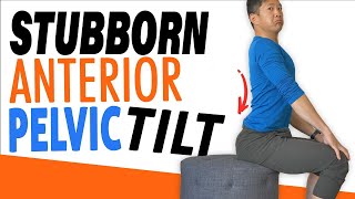 The Simple Fix for Anterior Pelvic Tilt [upl. by Aiotal888]