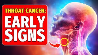 Dont Ignore 8 Early Warning Signs of Throat Cancer [upl. by Neened]