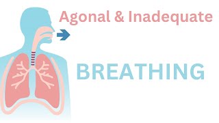 Agonal Breathing Demonstrated [upl. by Butler]