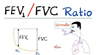 FEV1 FVC Ratio  Pulmonary Medicine  Obstructive VS Restrictive Lung Disease  Respiratory Physio [upl. by Odoric]