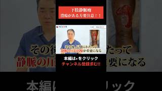 【現役医師が解説】潰瘍がある方は要注意下肢静脈瘤 病気 こむら返り [upl. by Ordisi]