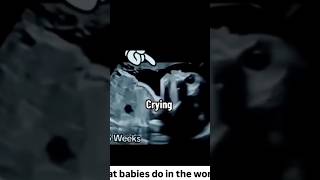 👼👼👼What Babies Do In The Womb 👼👼👼shortvideo baby [upl. by Zabrine948]