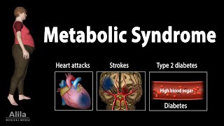 Metabolic Syndrome Animation [upl. by Ymmik]