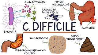 Understanding Clostridium Difficile Infection C Diff [upl. by Amatruda]