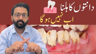 LOOSE TEETH Treatment Home Remedies [upl. by Jeromy]