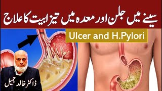 Stomach Ulcer and Acid Reflux  Lecture 198 [upl. by Dranyar]