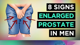 8 Signs You Have ENLARGED Prostate BPH  Men [upl. by Analli]