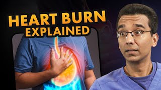 Say Goodbye to Heartburn The Complete Guide to FIX Heartburn GERD amp Acid Reflux [upl. by Enyawud902]