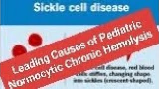 Leading Causes of Pediatric Normocytic Chronic Hemolysis SCD [upl. by Irej]