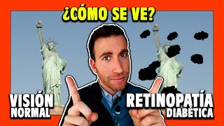 🟠 ¿Cómo VE una persona con RETINOPATÍA DIABÉTICA Cap 2 [upl. by Vladamar968]