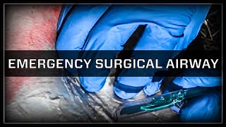 Emergency Surgical Airway  Cricothyroidotomy [upl. by Romain519]