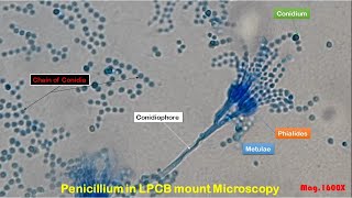 Penicillium in LPCB Mount Microscopy showing Condia ConidiophoresPhialidesmetulae Septate hyphae [upl. by Antin]