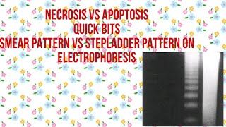 DIFFERENCE BETWEEN NECROSIS AND APOPTOSISWhat is Necrosis Vs What is Apoptosis [upl. by Sucerdor]